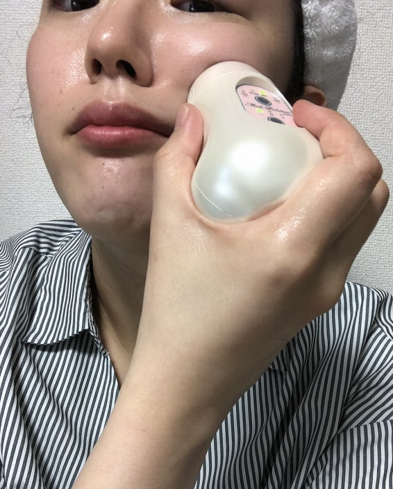 メディポレーションミニレビュー