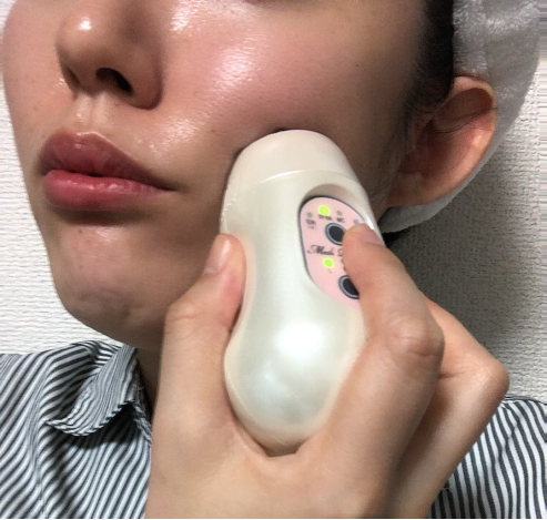メディポレーションミニ口コミ