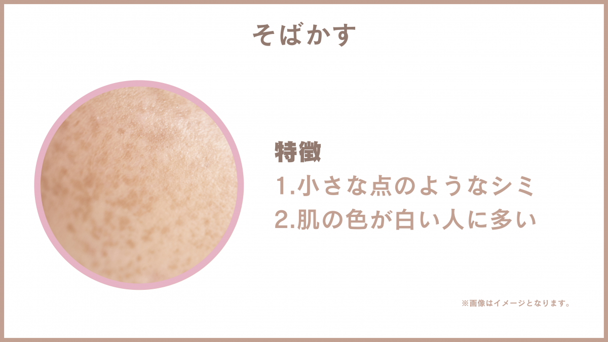 脂漏性角化層
