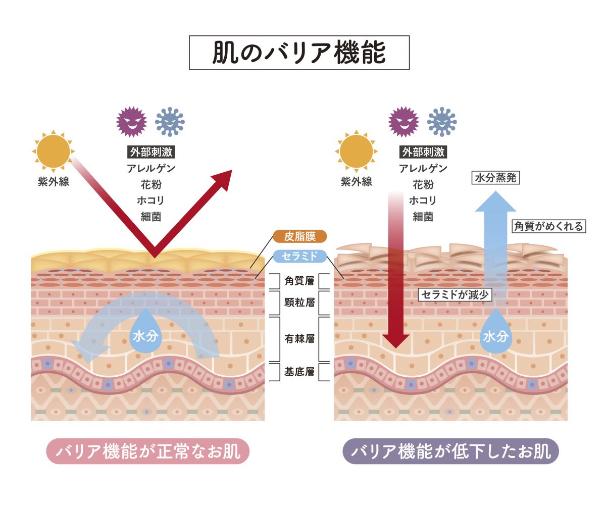 バリア機能が正常なお肌とバリア機能が低下したお肌