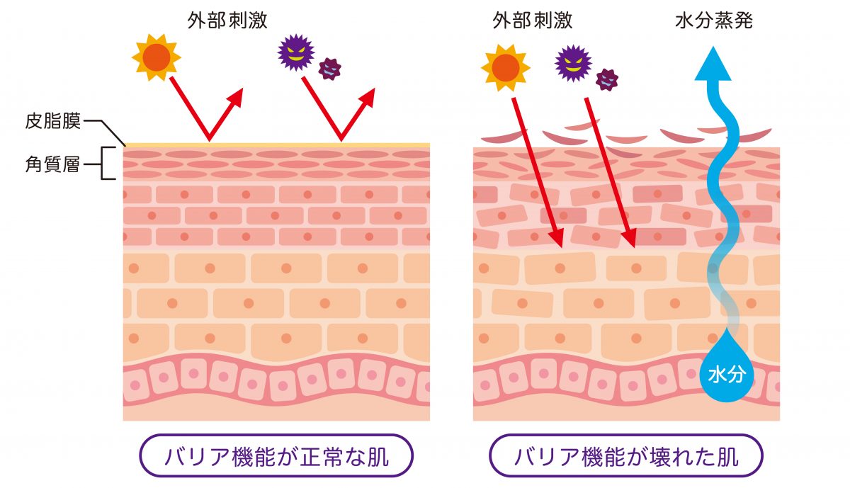 バリア機能が正常な肌とバリア機能が壊れた肌