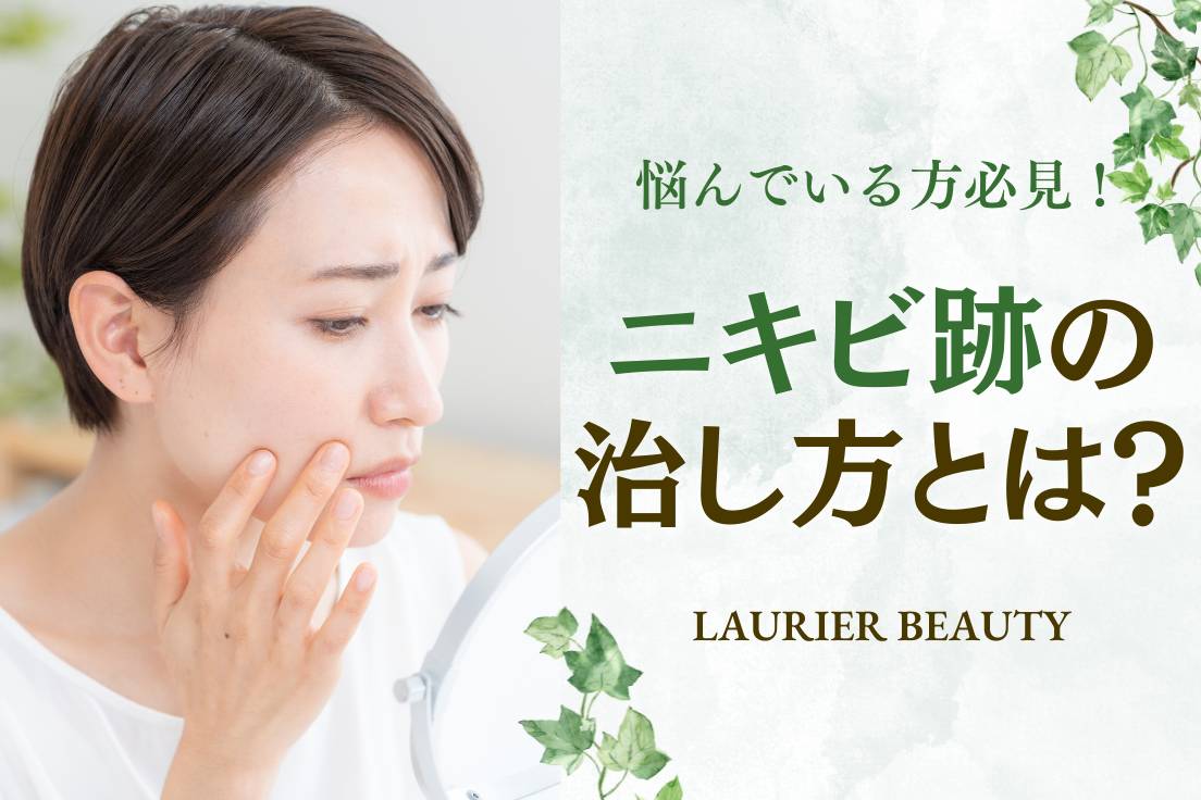 ニキビ跡の治し方とは？｜赤み・クレーター・色素沈着などの治療法や平均費用について解説