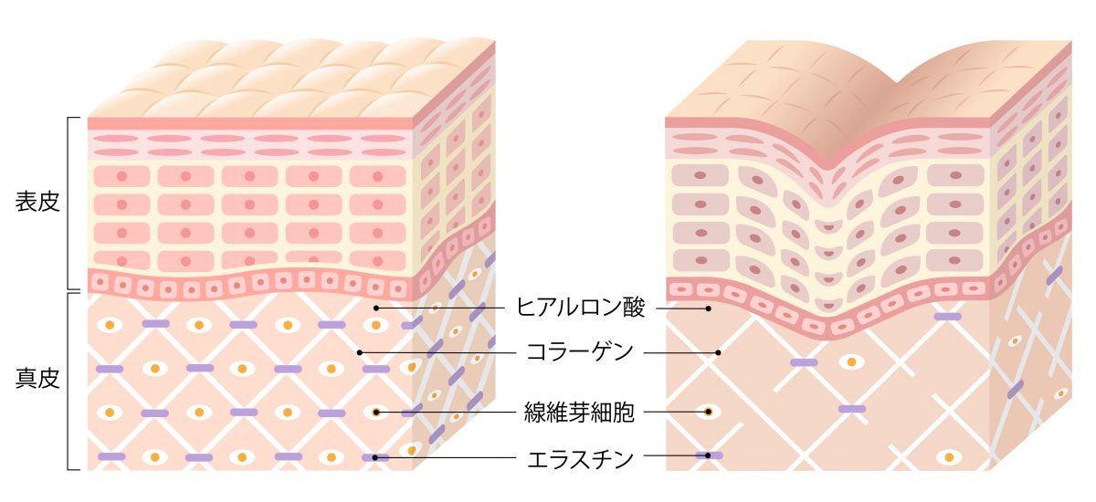 表皮と真皮の説明