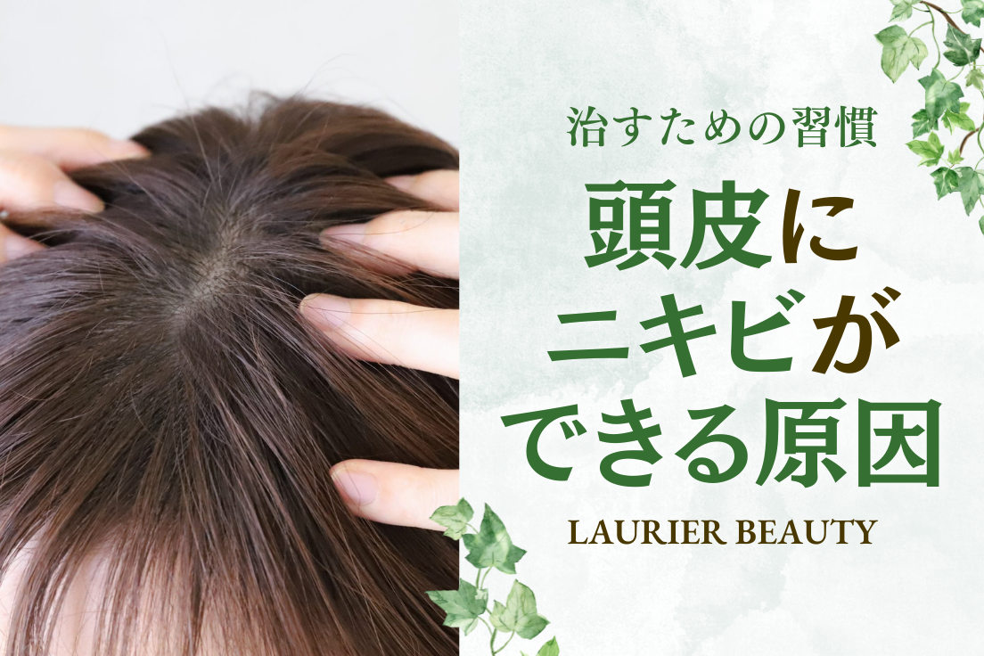 頭皮,ニキビ