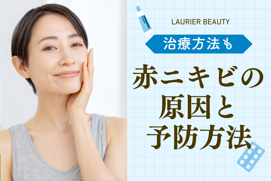 赤,ニキビ