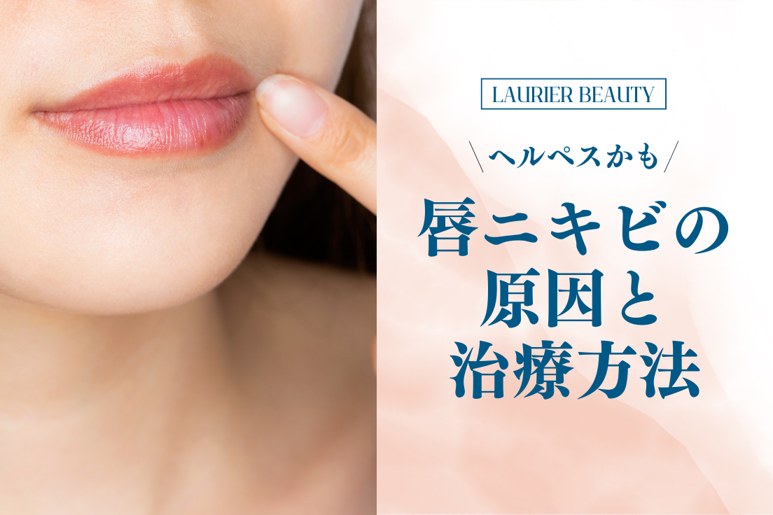 唇,ニキビ