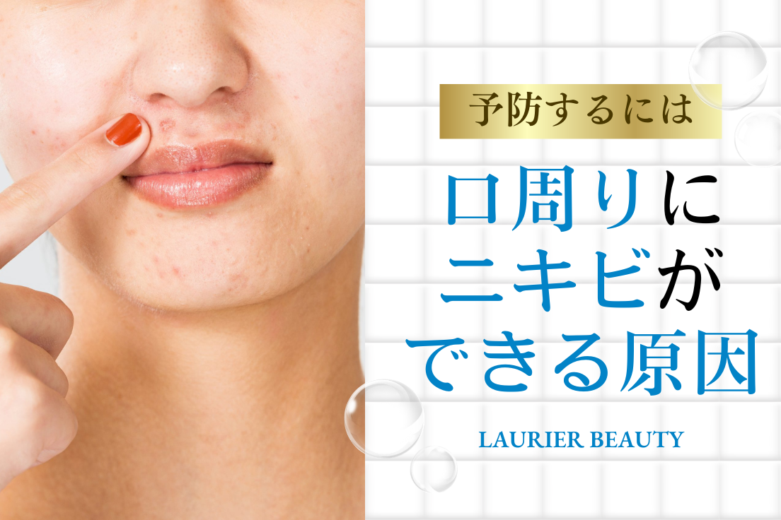 口周り,ニキビ