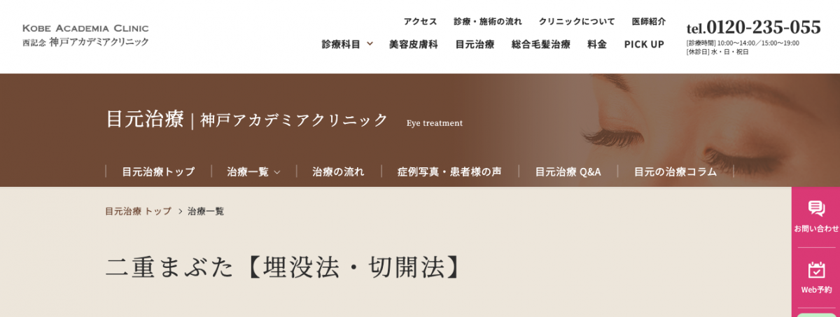 神戸アカデミアクリニック,二重整形