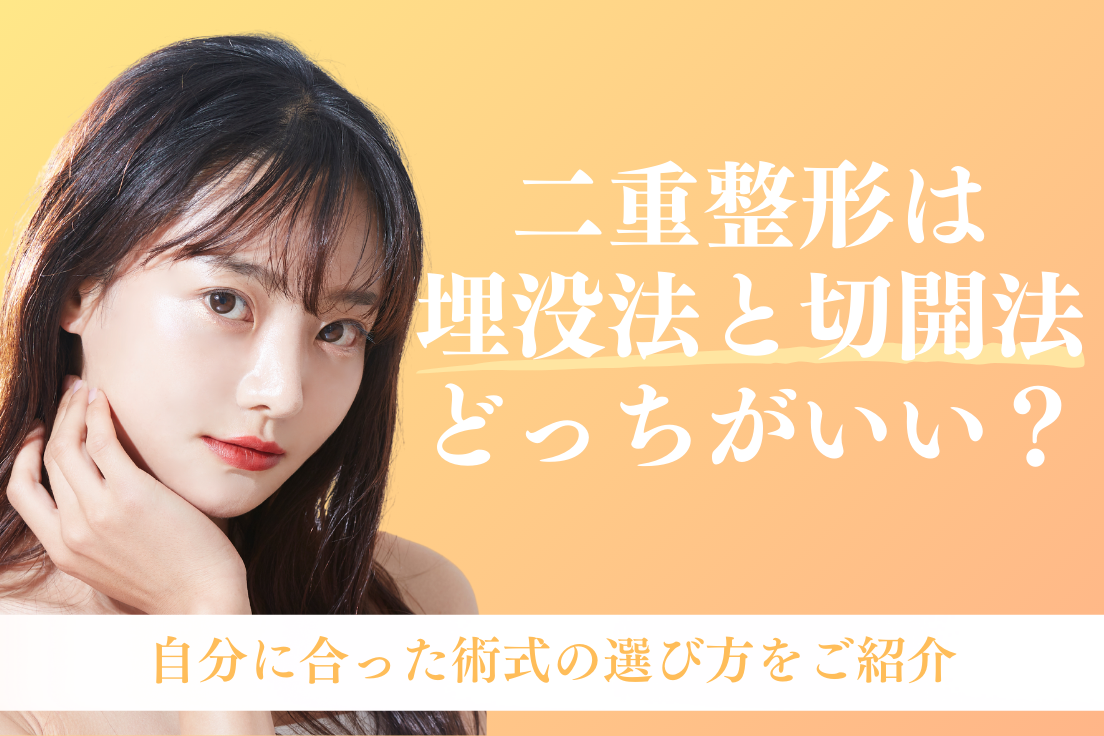 二重整形,埋没,切開,どっちがいい (1)