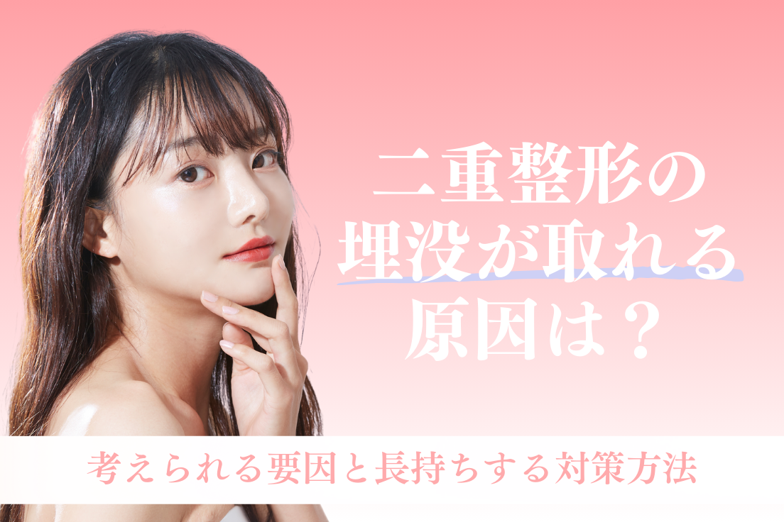 二重整形,埋没,取れる