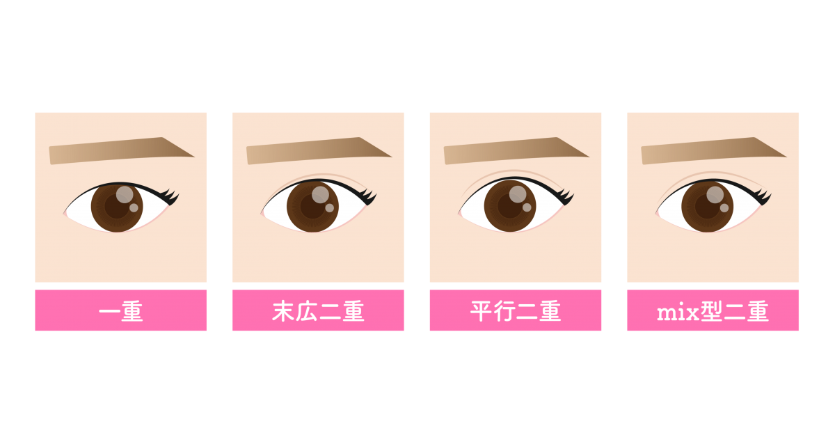 二重の種類