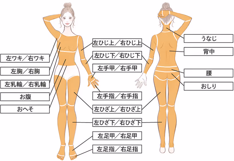 レジーナクリニック(全身脱毛)