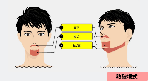 メンズリゼ