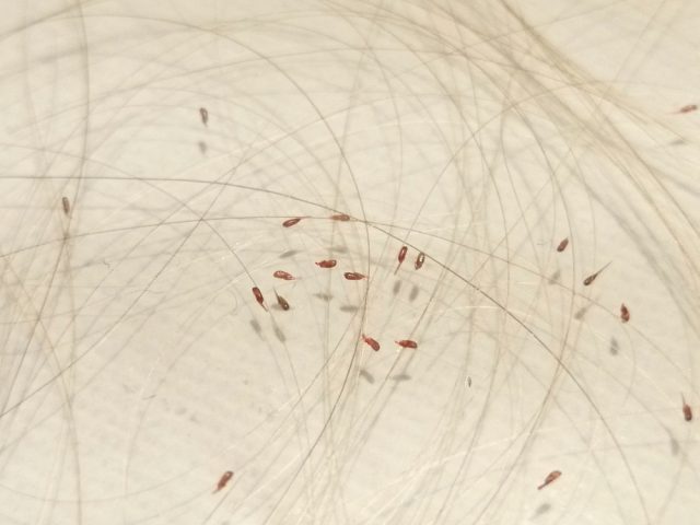 猫の寄生虫 人間にうつる種類や完全に駆除する薬 治療法まとめ